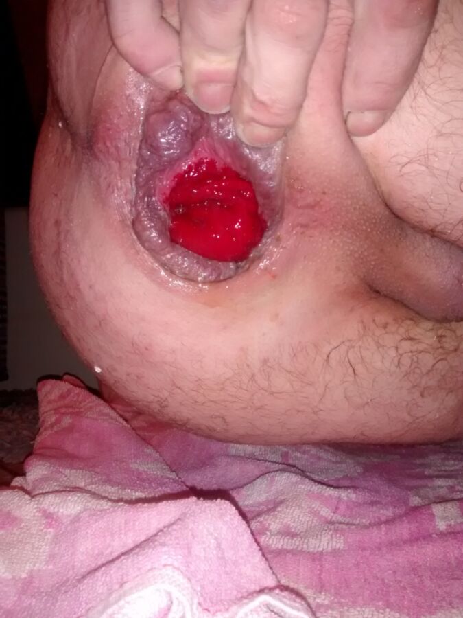 Free porn pics of pumping my cunt to revea my biggest prolapse yet!!! 13 of 24 pics