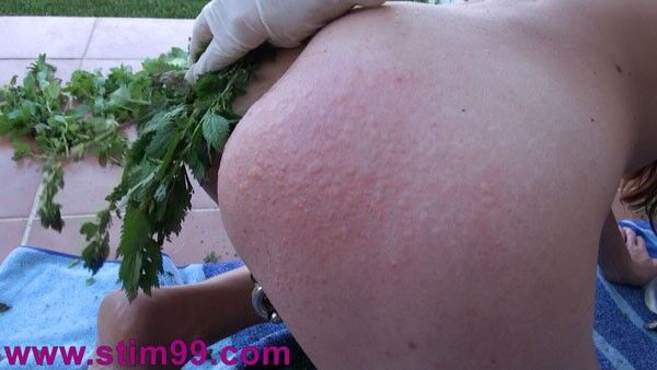 Free porn pics of Stinging Nettle Torture in Pussy and Breast 15 of 18 pics