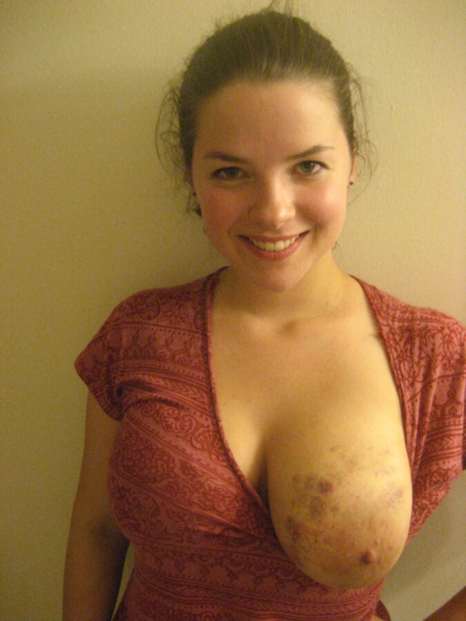 Free porn pics of Brynn Breast 13 of 349 pics