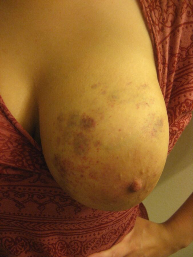 Free porn pics of Brynn Breast 11 of 349 pics