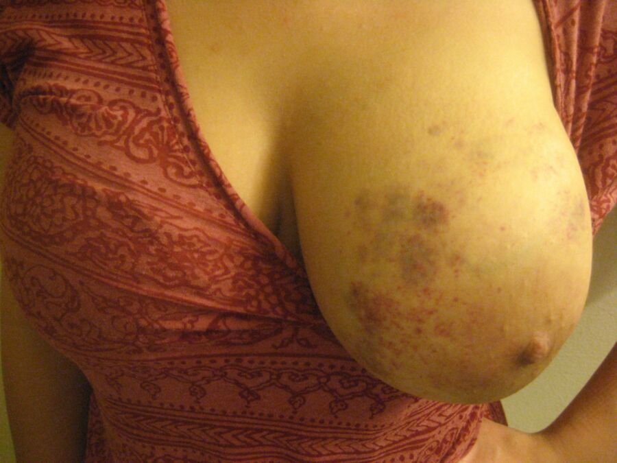 Free porn pics of Brynn Breast 12 of 349 pics