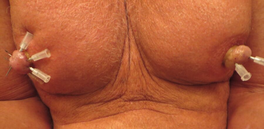 Free porn pics of needled nipples 10 of 10 pics