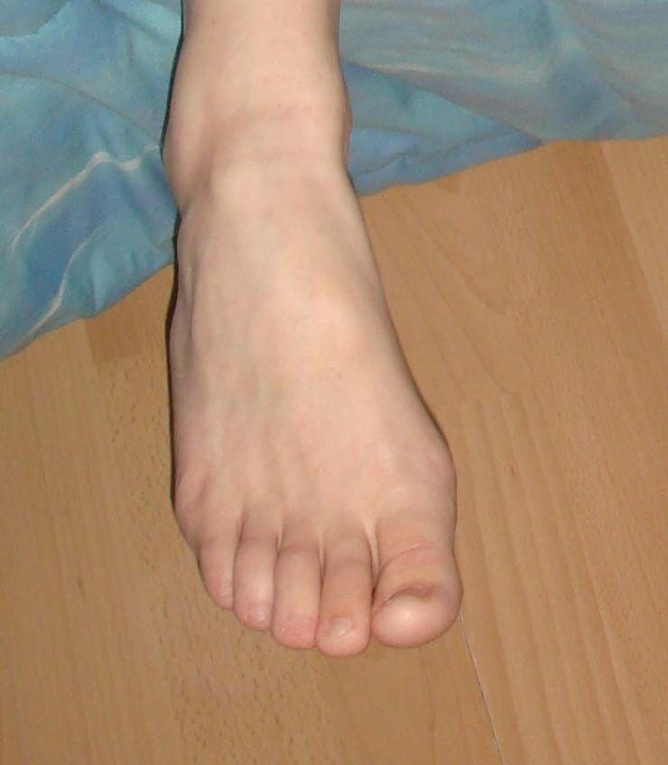 Free porn pics of the feets of my wife for people which loike that 7 of 19 pics