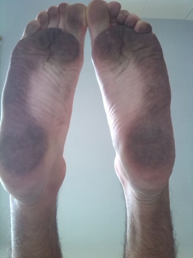 Free porn pics of My dirty soles 5 of 20 pics