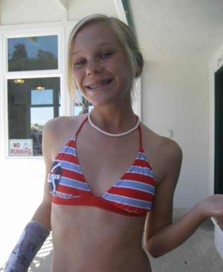 Free porn pics of ...Something About Girls with Braces... 20 of 50 pics